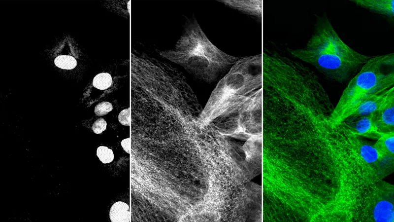 Deux images de fluorescence d'un substrat cellulaire de BPEA prises avec un capteur CMOS IMX174 à éclairage frontal dans un monocaméra MED ace 2,3 MP. Les images montrant différentes structures cellulaires sont colorées et fusionnées par le logiciel.