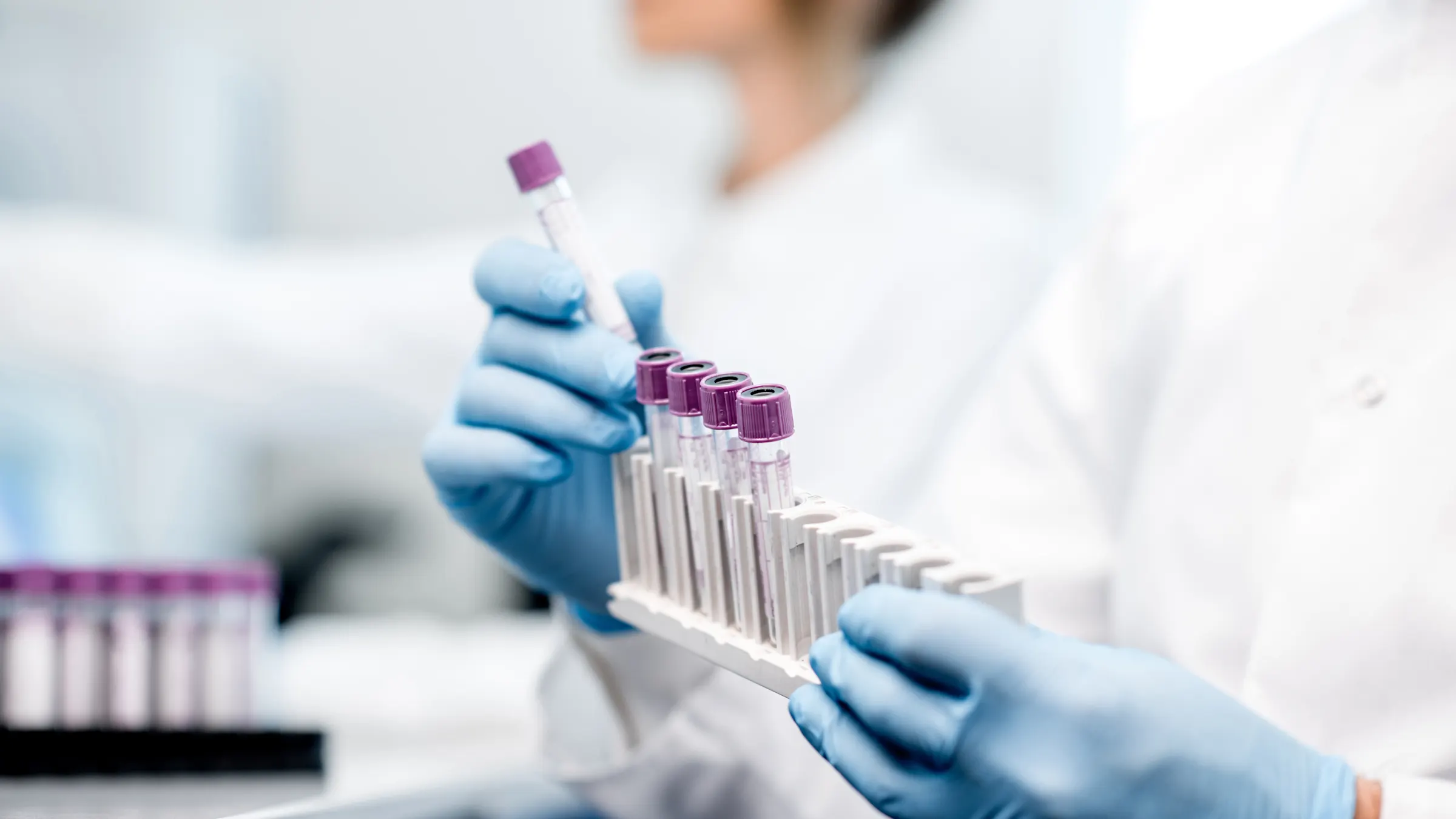 The Fluxergy system enables transportable PCR tests in any environment and can be performed within 15-60 minutes from sample collection.