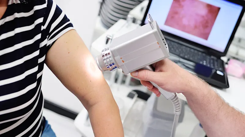 Cameras in dermatology