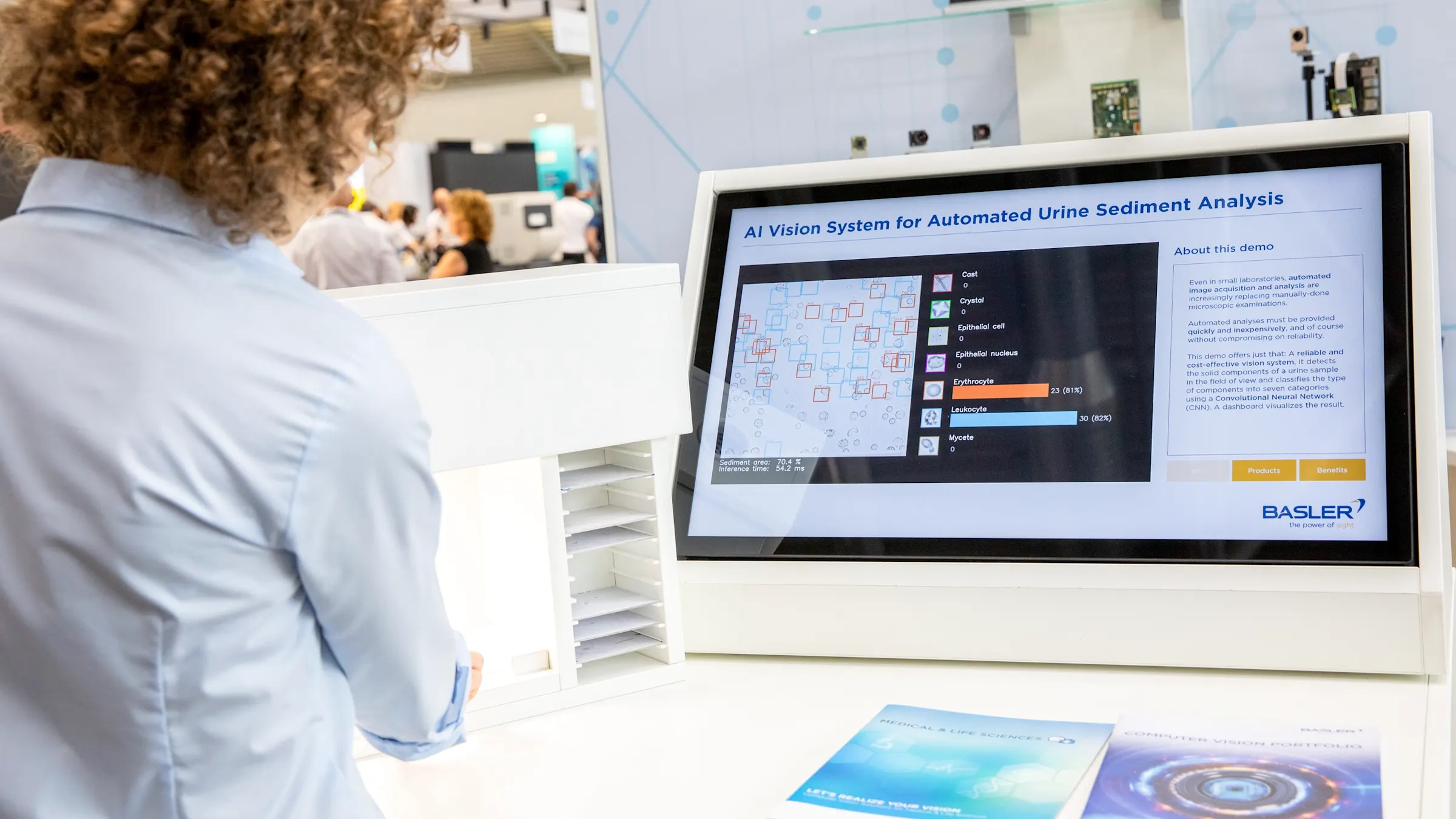 Kostengünstige Urinsediment-Untersuchung mit CNN-basiertem Vision System