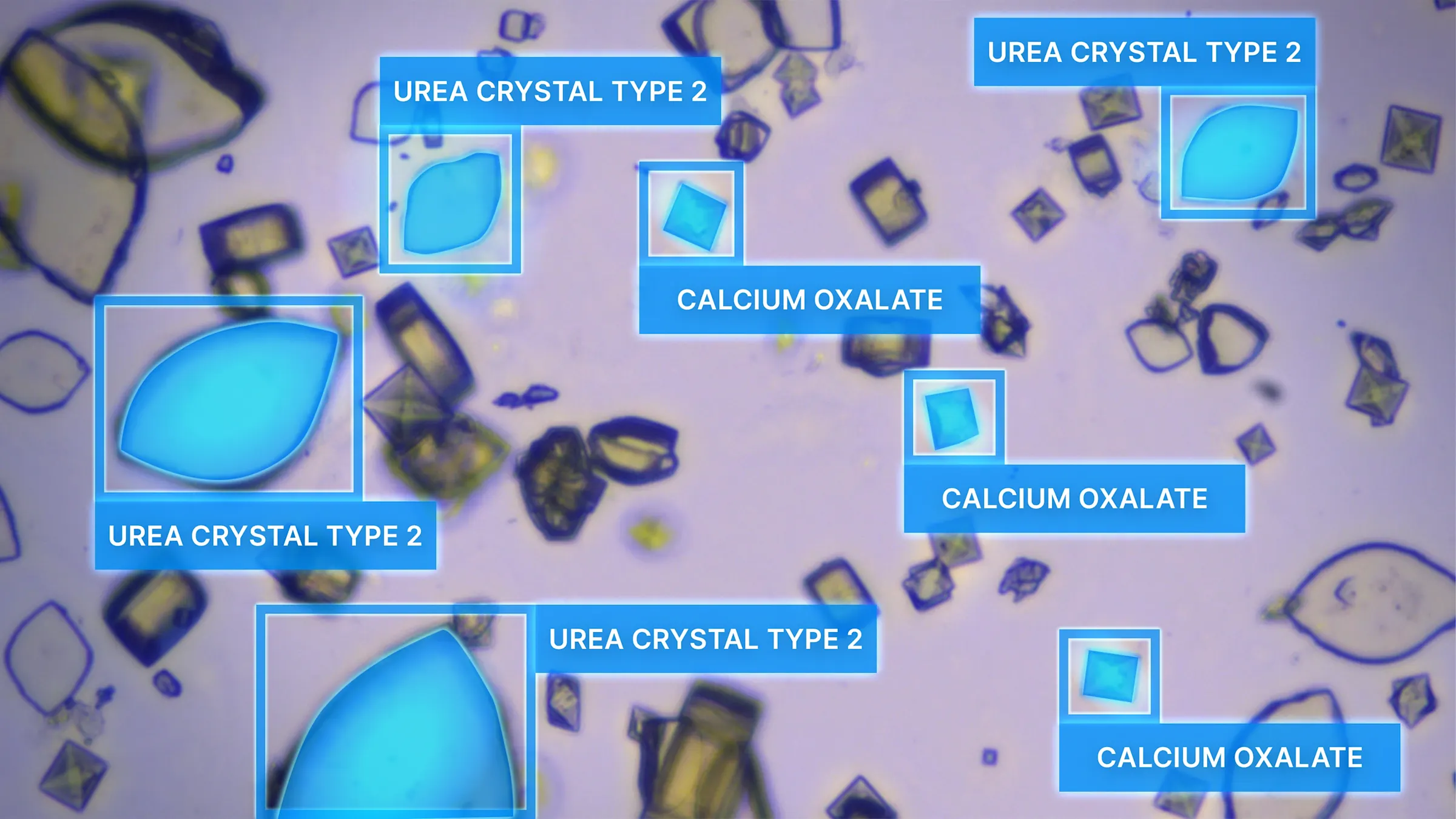 CNN 기술 기반 비전 시스템을 활용한 비용 효율적인 소변 침전물 검사