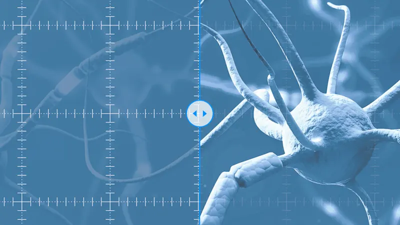 Deep Learning in computer vision applications