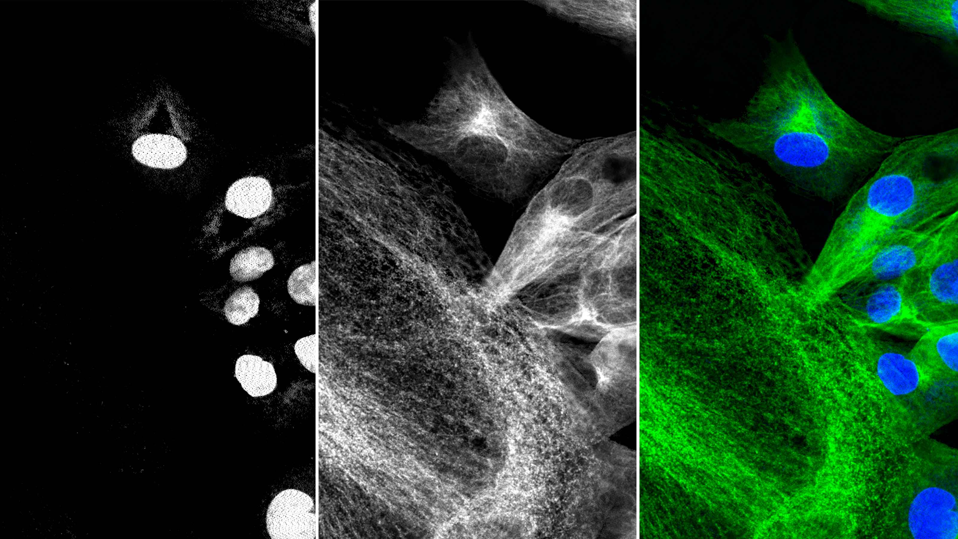 Zwei Fluoreszenzbilder eines BPEA Zellsubstrats, aufgenommen mit einem frontal beleuchteten IMX174 CMOS-Sensor in einer MED ace 2,3 MP Monokamera. Die Bilder, die unterschiedliche Zellstrukturen zeigen, werden per Software eingefärbt und zusammengeführt,.