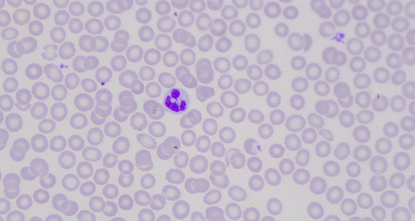 Immagine con regolazione del colore magenta nell'Operatore a 6 Assi