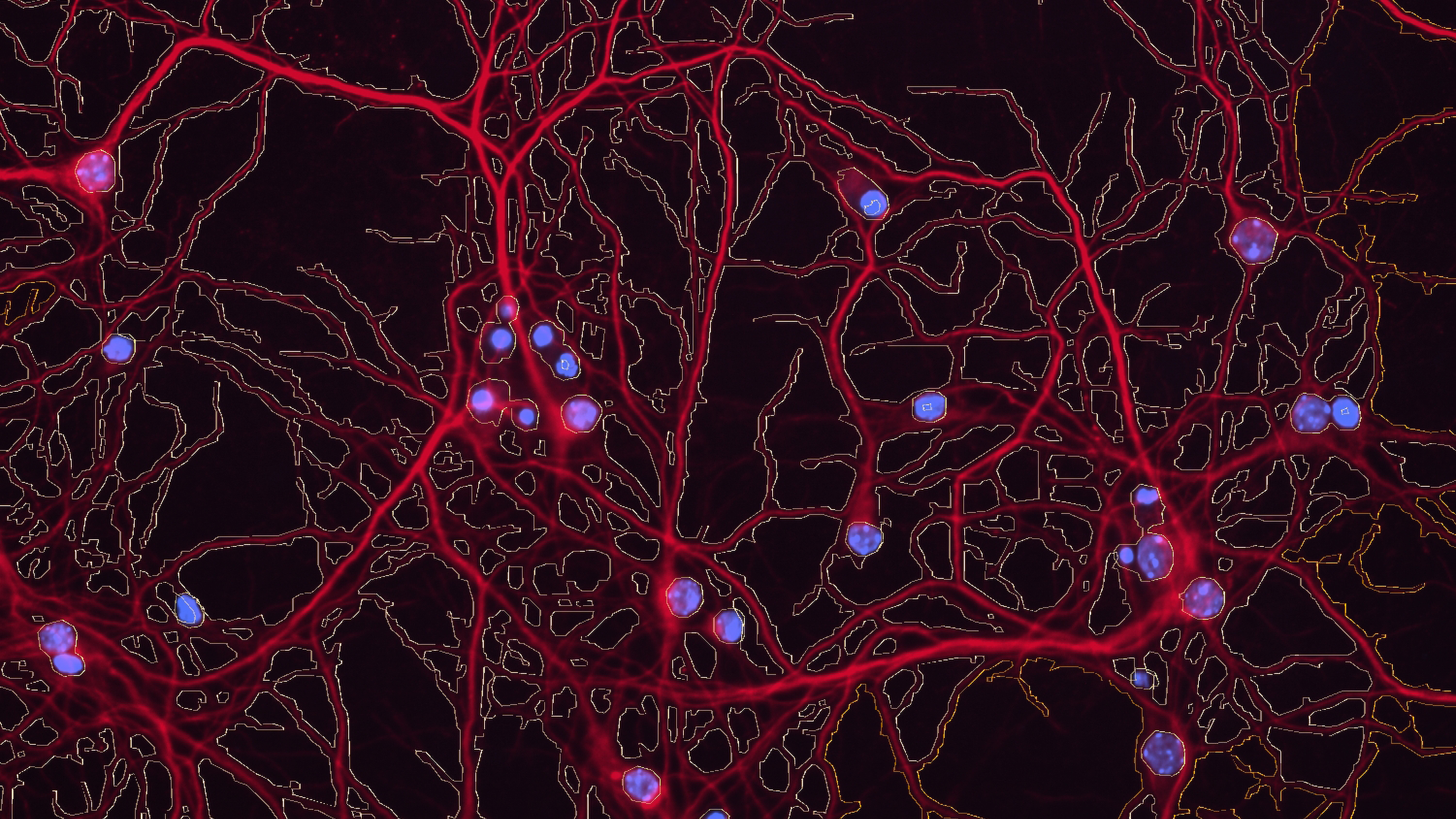 Cross-section of a brain in nanometer scale