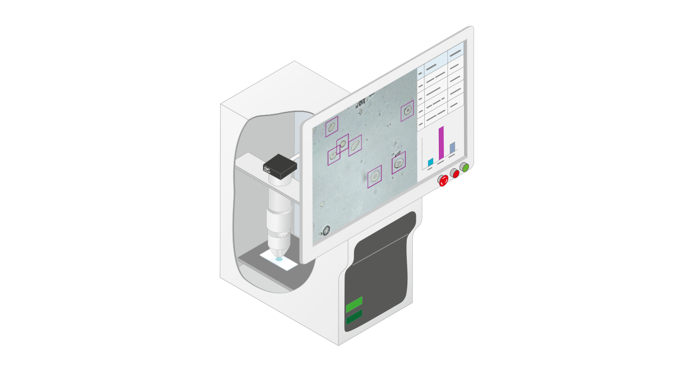 CNN-basierte automatische mikroskopische Urinsediment-Untersuchung - Vision-Lösung von Basler