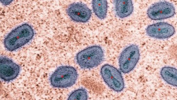 Intensity-weighted centroids per cell enable rapid counting, density metrics, and motion tracks.