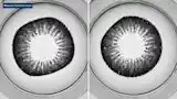 A typical contact lens inspection system combines darkfield illumination, precision optics, and industrial imaging.