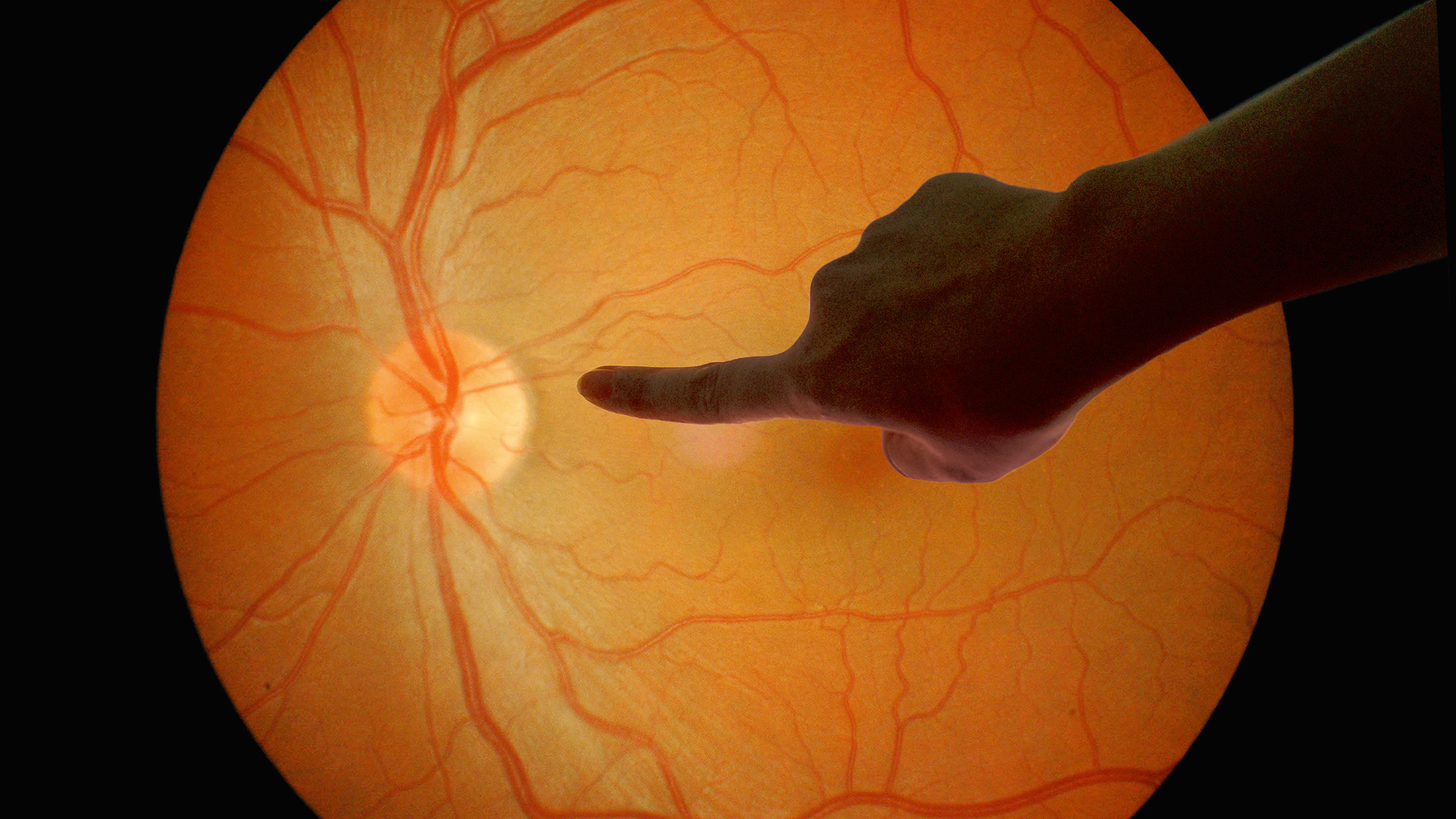 Why color calibration is important in medical technology