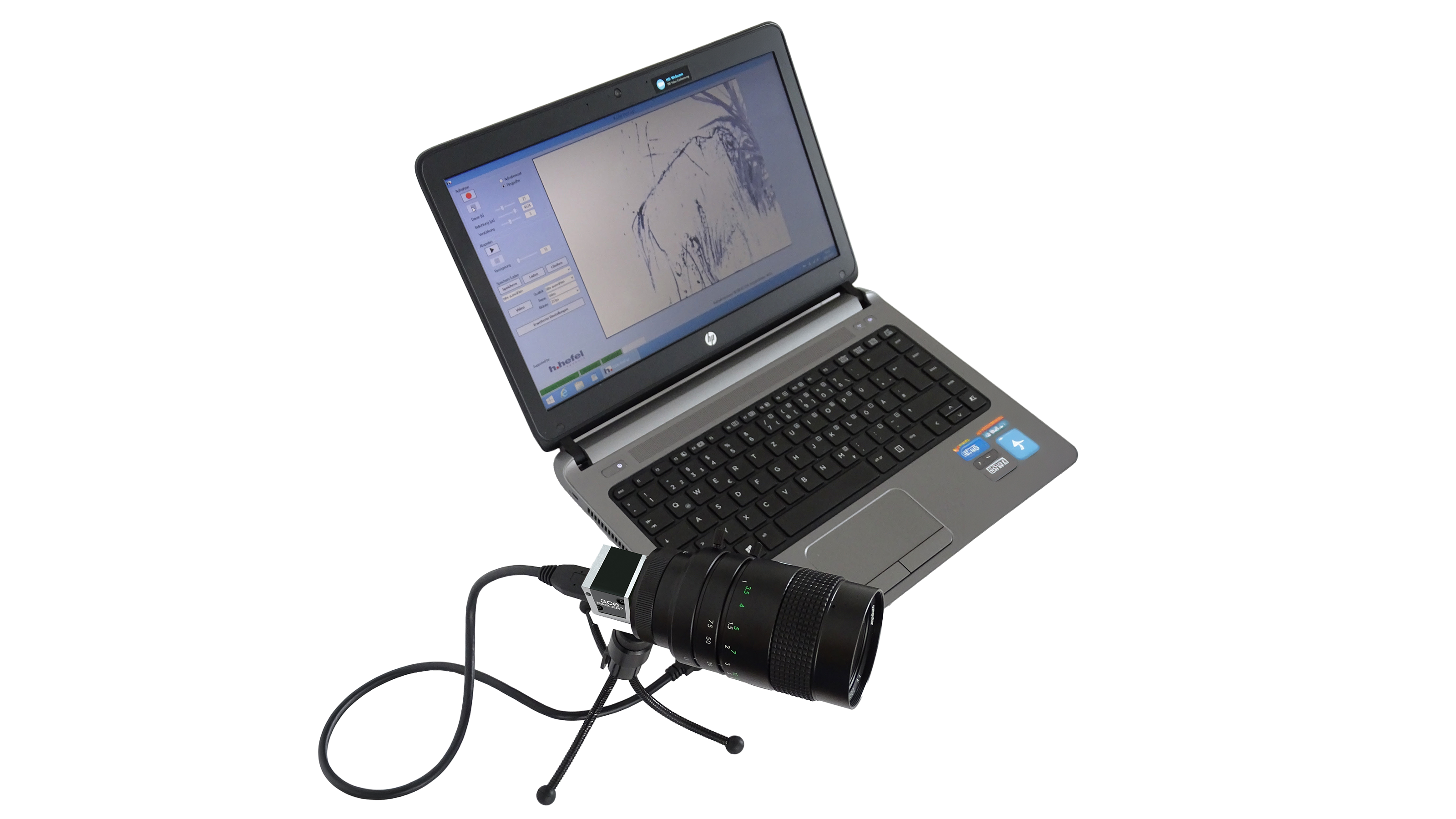 Il sistema X.Lite ProCap è costituito da una videocamera USB 3.0 collegata a un computer portatile