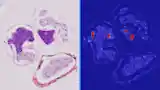 Image analysis in medicine