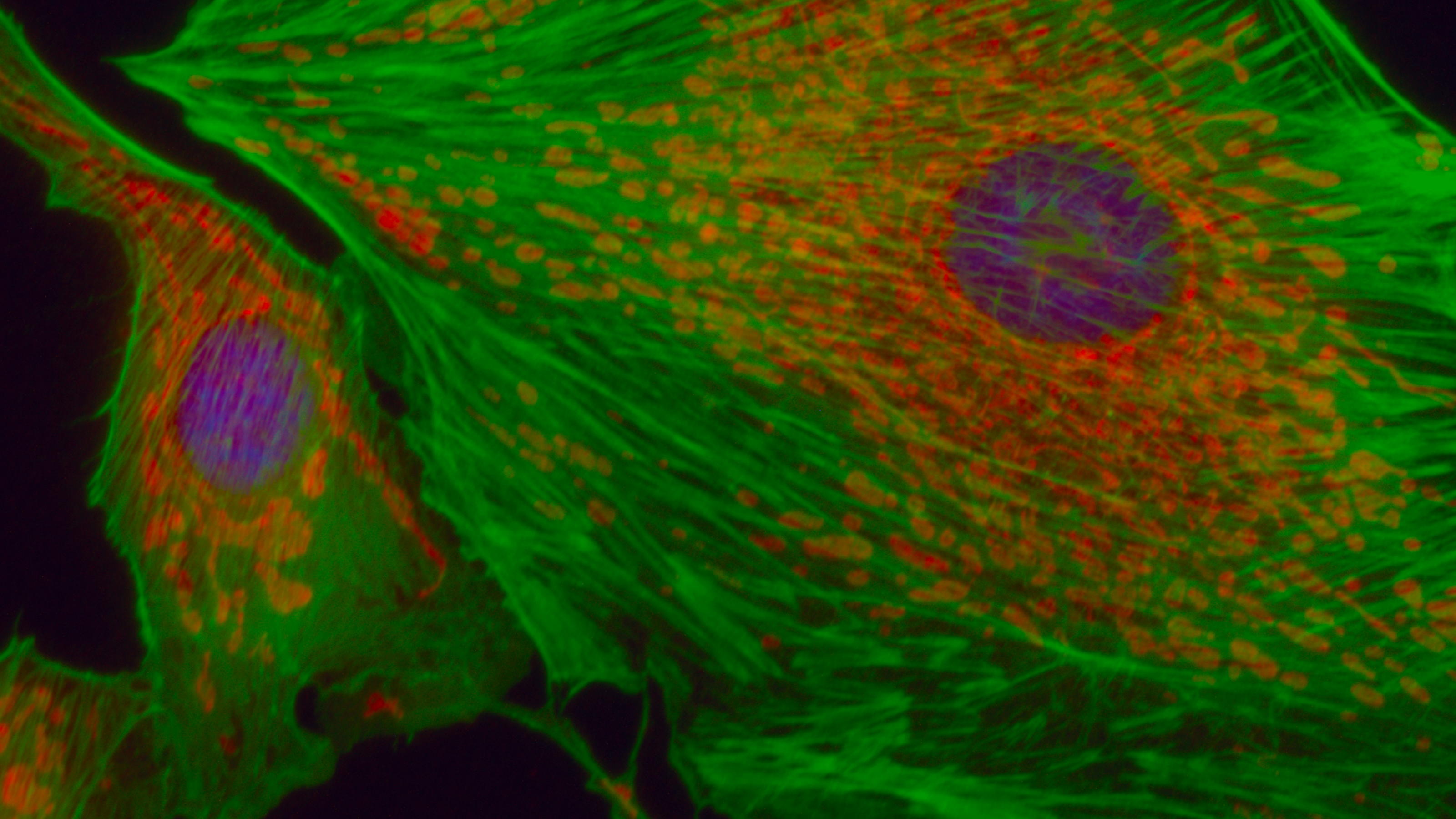 CMOS sensors in fluorescence applications