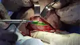 Visualization in medicine
