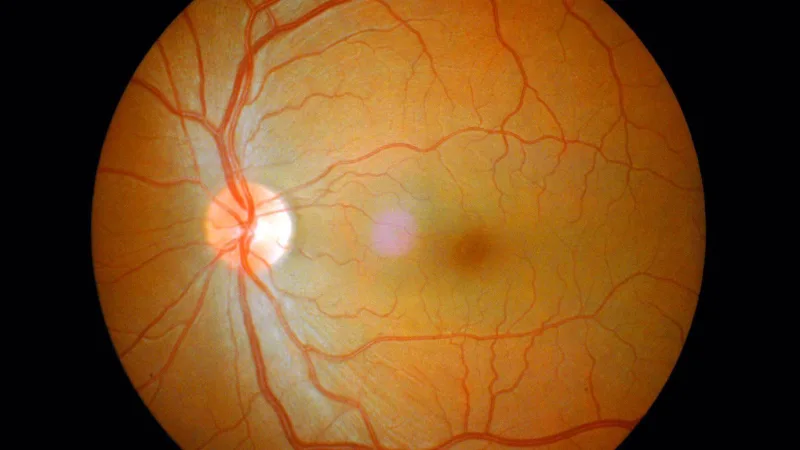 カラーによる眼科検査（網膜の画像）