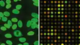 Figure 8. Immunofluorescence microscopic assay in autoimmune diagnostics (left). A DNA micro- array used in cancer and other disease research (right).
