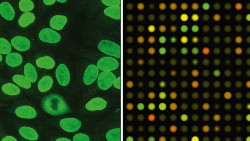 自體免疫診斷中的免疫螢光顯微鏡測定（左）。一種用於癌症和其他疾病研究的 DNA 微陣列（右）。
