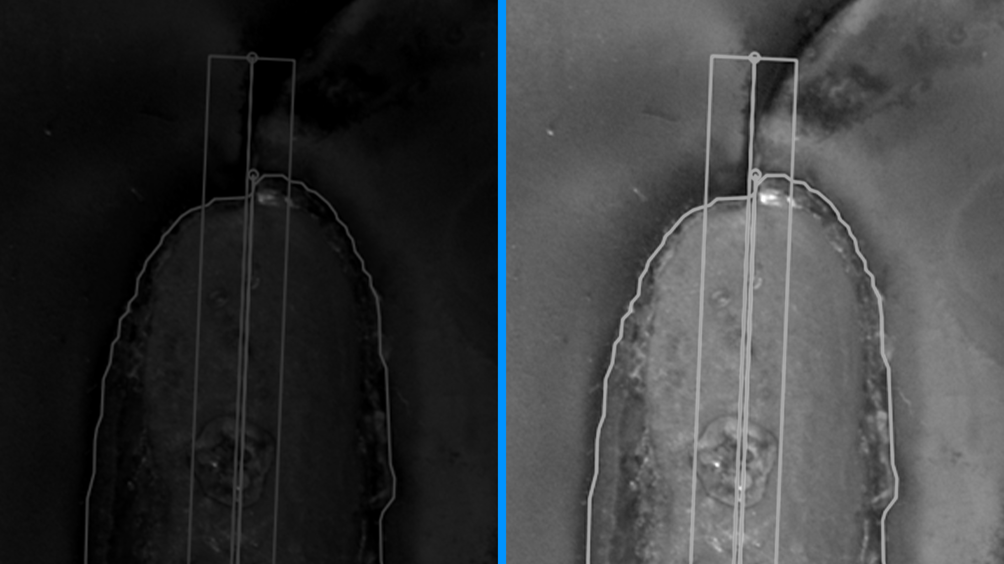 Histogram equalization for industrial image processing