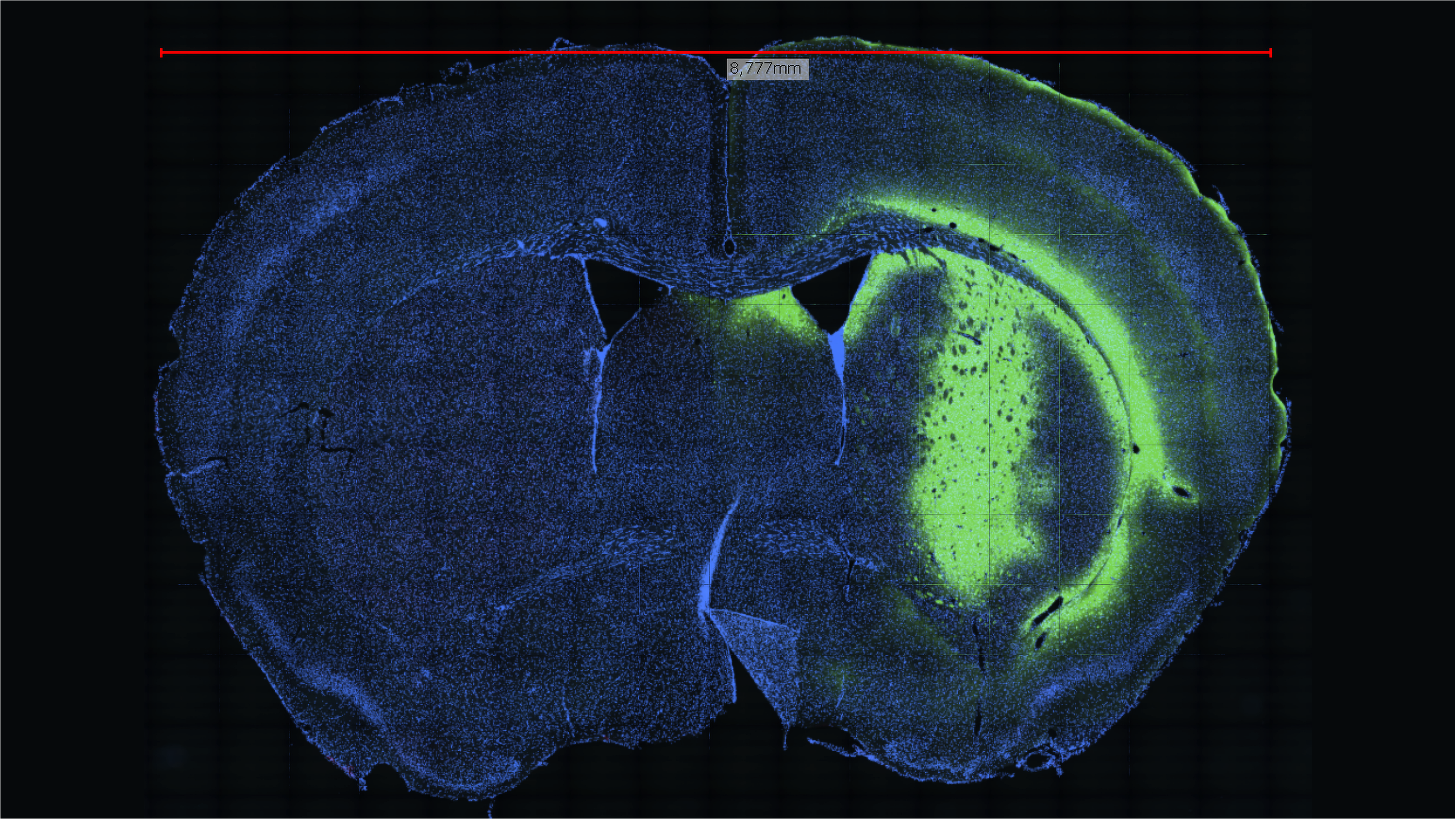 Cross-section of a brain in millimeter scale